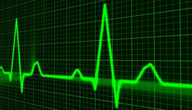 Apache Brooklyn 1.0 arrives for autonomic cloud computing